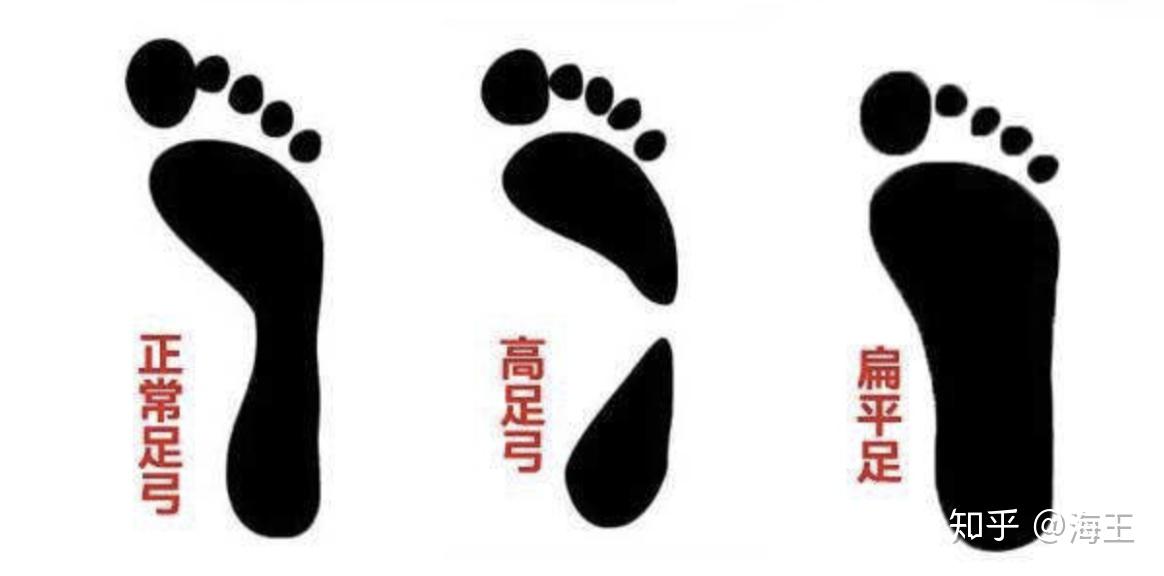 正常内旋